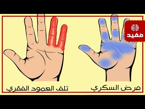 7 أعراض تظهر على اليد للتنبيه بوجود أمراض خفية داخل الجسم