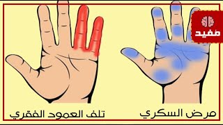 7 أعراض تظهر على اليد للتنبيه بوجود أمراض خفية داخل الجسم