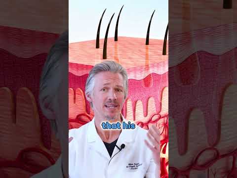 HAIR LOSS MIRACLE AT EARLY FORTIES: DHT VS INFLAMMATION TRANSFORMATION!