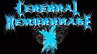 Cerebral Hemorrhage - Deranged Perception