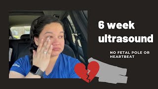 6 week ultrasound - no fetal pole or heartbeat 💔  | My Surrogacy Journey