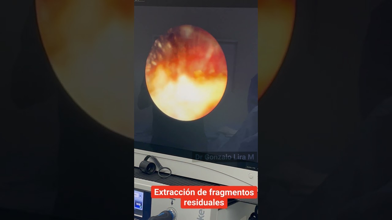 Gonzalo Lira Moreno-13