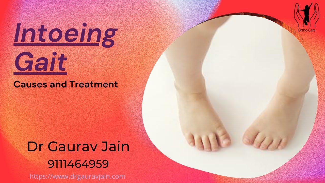 Intoing Gait in Children – Causes, Diagnosis & Treatment | Dr. Gaurav Jain, Indore