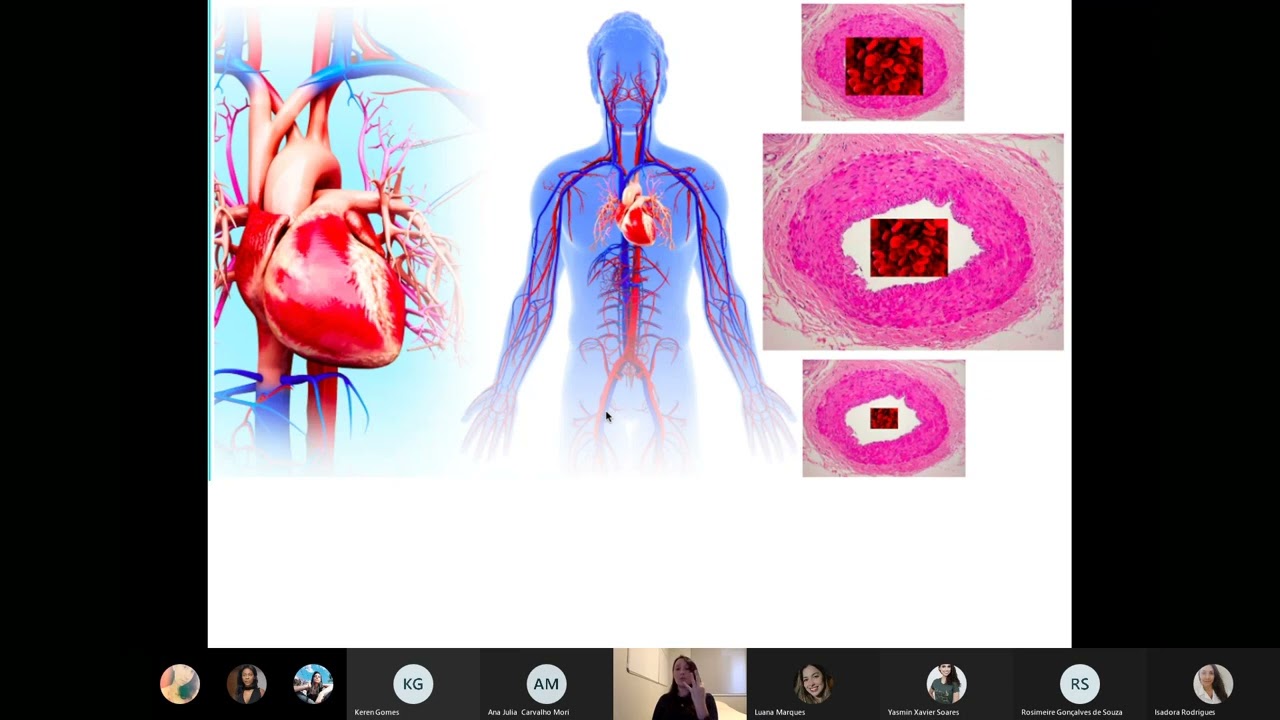 Choque - Aula Enfermagem