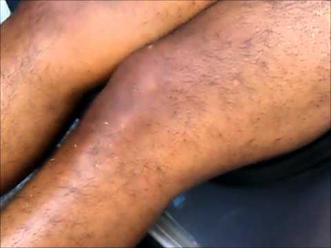 download lagu mp3 mp4 Hairy Sites, download lagu Hairy Sites gratis, unduh video klip Hairy Sites