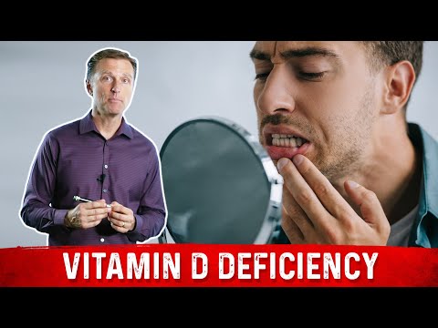 An APPLE a Day Will NOT Let Your Weight Go Away – Dr Berg