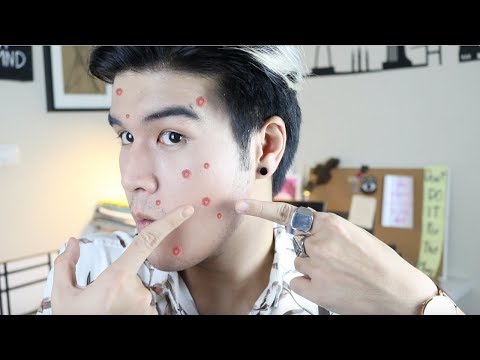 ล้างสำหรับโรคสะเก็ดเงิน ไฮโดรเจนซัลไฟด์ห้องน้ำโรคสะเก็ดเงิน