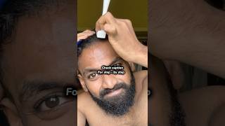 Derma rolling methods #hair #hairlosstreatment #dermaroller #dermarolling