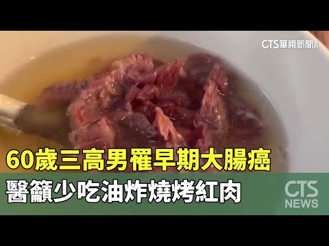 60歲三高男罹早期大腸癌　醫籲少吃油炸燒烤紅肉