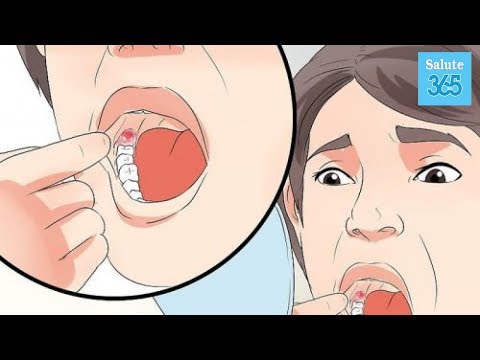 Caviglia rottura del legamento guarisce molti Dolore al collo alla sinistra del bambino