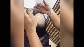 how to fix french lace hair system by lace hold glue | Joker Wigs