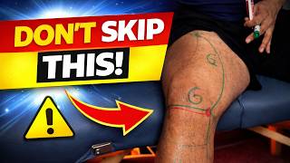 Genicular Nerve Block for Knee Pain??