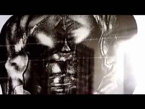 The Truth About Steriods & Synthol - Steroid Documentary