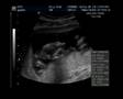 Baby Closeup