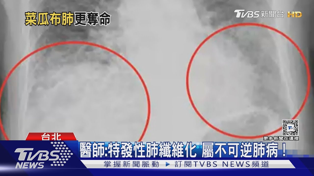 呼吸困難！竟是身體「這器官」受損　醫師警告：死亡風險高！