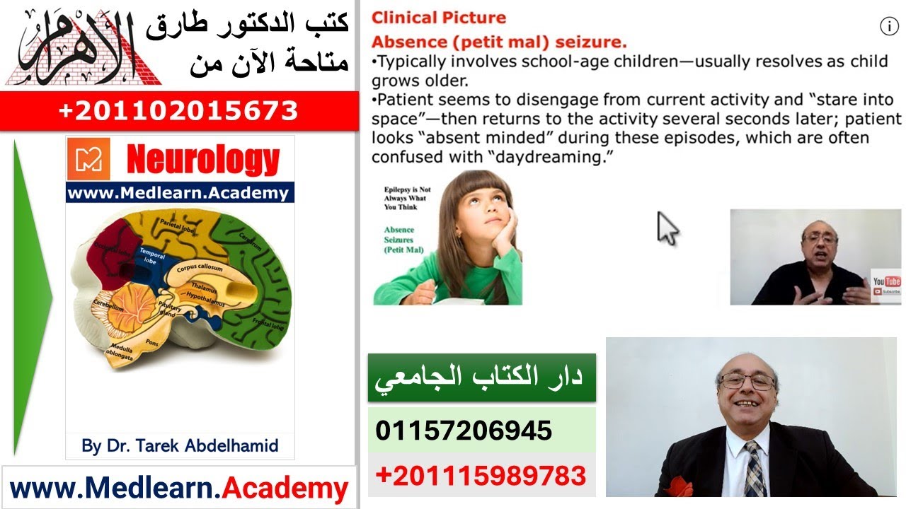 Epilepsy [Part2] (Medical Quizzes)  (EMLE) #CME #Internal_Medicine   #ECG #usmle   محاضرات باطنة#