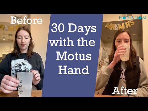 Making Gains after a Stroke is hard, but it's Possible with Motus Nova