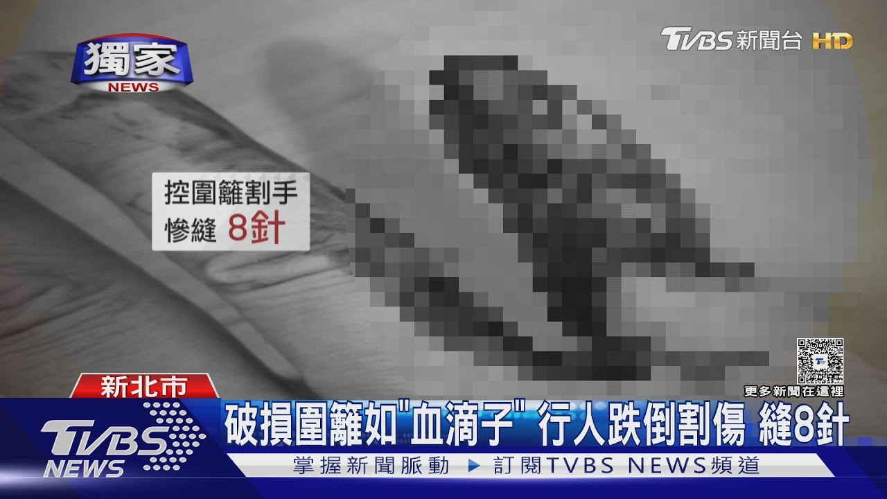 獨/為了閃「這坨」跌倒!鐵皮圍籬如血滴子 行人慘縫8針