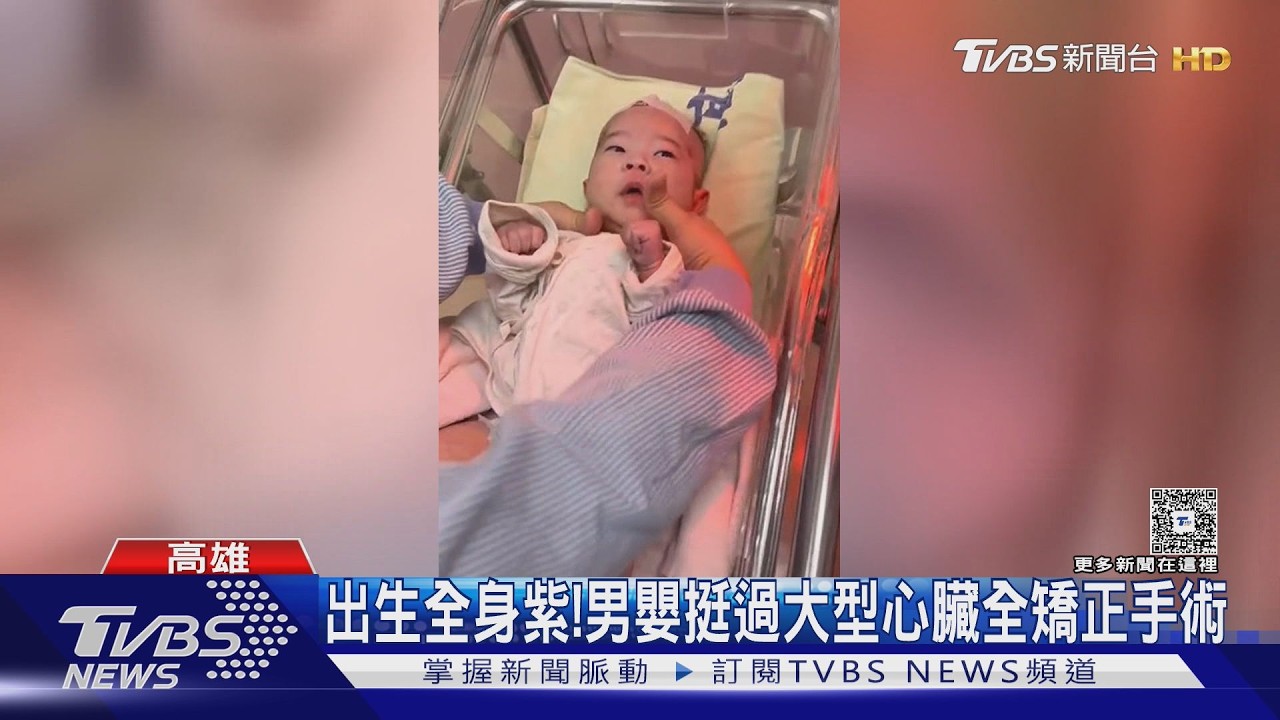 影音／產檢驚見大動脈錯位！　2週大男嬰開心臟搶命