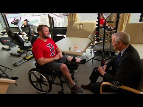Veteran with severe leg injuries undergoes advanced amputation
