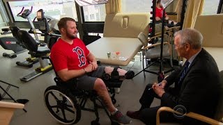 Veteran with severe leg injuries undergoes advanced amputation