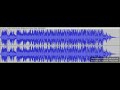 Future ONLY - Mbappe Remix (Official Audio) | 3MEN 2KBRN
