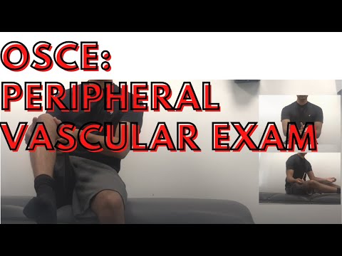 OSCE Peripheral Vascular Examination | Pulses