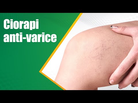 pregatiri de la venicose vene recenzii