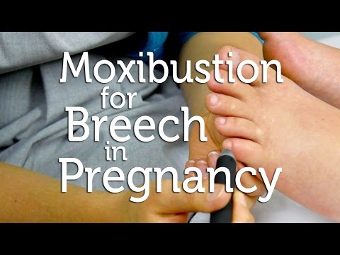 a moxibustion condoxom hatása