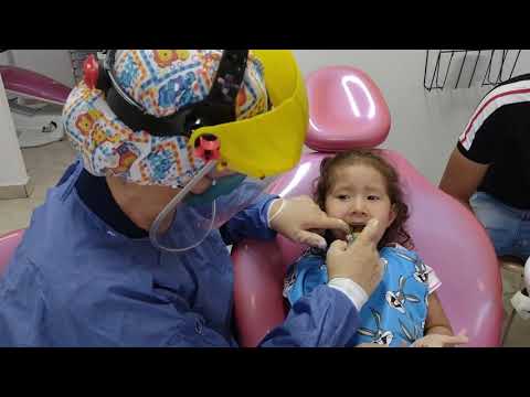 Odontólogo para niños  en Barranquilla Mordida cruzada anterior en niños - Smile Center