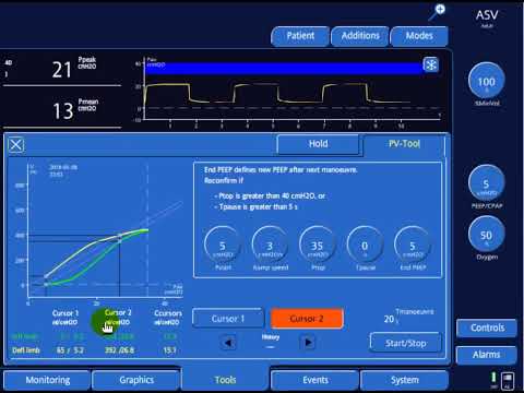 Assessing Lung Recruitability with the P/V Tool Pro: Benefits for ARDS Patient