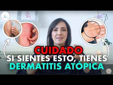 🔴 WHY IS MY SKIN ITCHY? How do I cure it? @drapilarochoa - Dermatologist