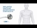 Port A Cath Implanted Vascular Access Device