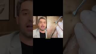 botox caseiro #belezafeminina #belezanatural