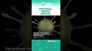 Jangan Abaikan Benjolan Kecil di Organ Intim, Inil Tanda Penyakit Herpes Genital