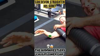Download lagu Can Devon Larratt Fully Straighten His Arm?!💪💀 mp3