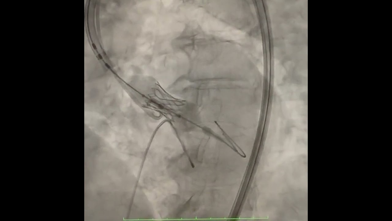 Hedilberto Feitosa-22