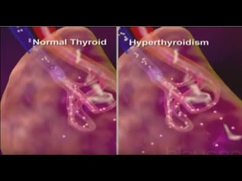 Fitness sayawan sa bahay para sa pagbaba ng timbang video Ako hindi nawawala ang timbang diyeta forum