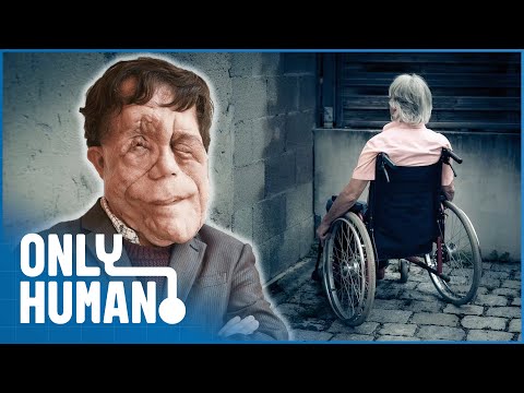The Ugly Face of Disability Hate Crime: Adam Pearson Investigates