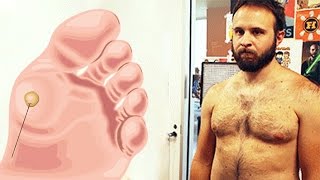 BRUCE'S TERRIBLE WARTS - Dude Soup Podcast #75