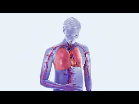 Tiefe Venen Thrombose und Lungenembolie