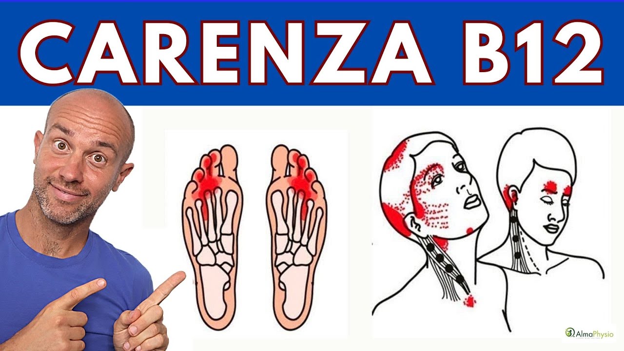 i SINTOMI di CARENZA di Vitamina B12 che DEVI CONOSCERE