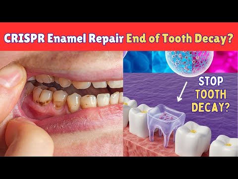 CRISPR Enamel Repair: The End of Tooth Decay | Medical Miracle