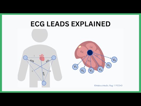 ECG Leads Explained