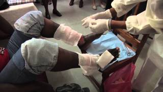 BBDC Guyana Diabetes and Footcare Project
