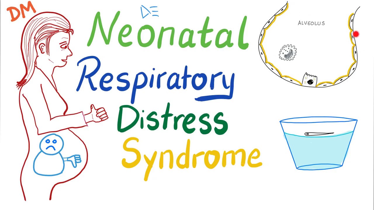 Neonatal Respiratory Distress Syndrome (NRDS) - Pediatrics - Pulmonology