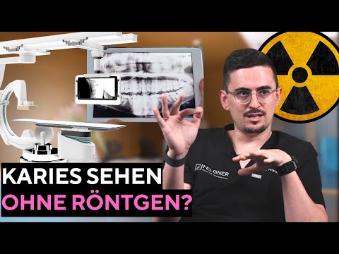 Wie dein Zahnarzt keine Karies mehr übersieht! | Röntgenmethoden im Vergleich.