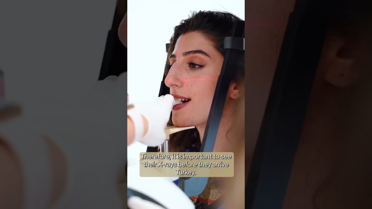 How Long Should Patients Stay in Turkey When They Come for Treatment? #dentaltourismturkey