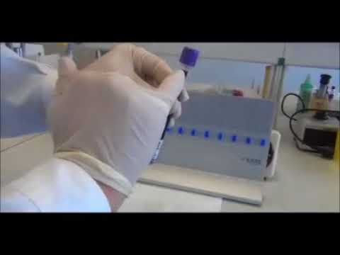 Velocidade de Sedimentação (Escala Semi Logarítmica)