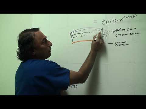 LASIK Flap: Pros, Cons & Expert Insights | Dr. Rajesh Khanna MD